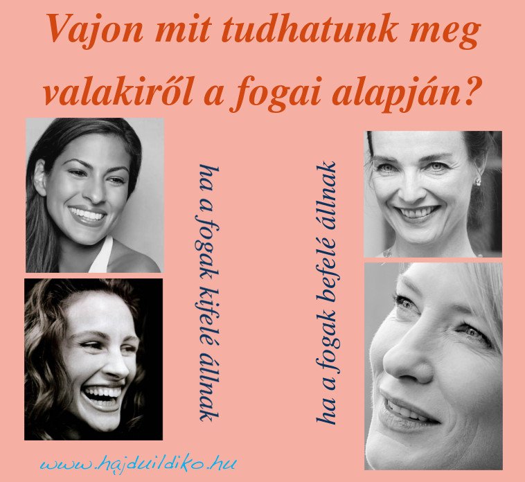 fogak állása, kifelé álló fog, befelé álló fogazat
