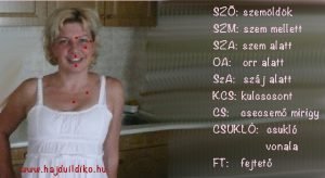 ÉFT kopogtatós gyakorlat, hogy el tudjuk engedni az orvosokról elkotott véleményt, ítéletet, és a félelmeket.